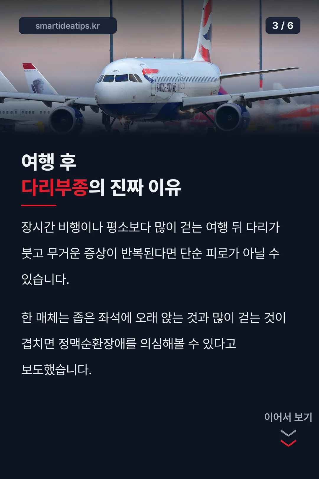 여행 후 다리부종 의외사실