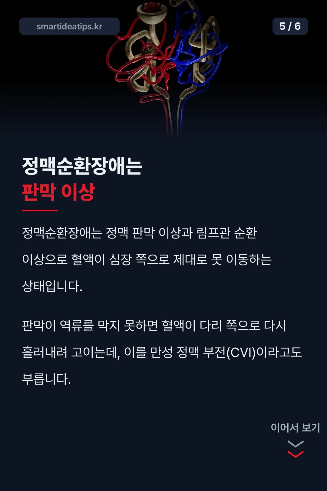 정맥순환장애 원인
